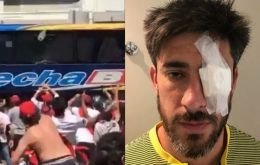 Izquierda: El autobús con los jugadores de Boca es atacado con piedras y objetos. Derecha: El capitán de Boca, Pablo Pérez, trminó con un parche ocular el sábado.