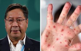 Arce apuntó a que el sarampión se propaga más rápido y ampliamente que la Covid-19