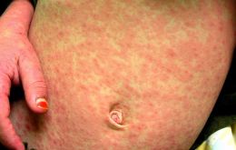 Los viajeros que regresan de Europa o Estados Unidos deben estar atentos a los síntomas respiratorios