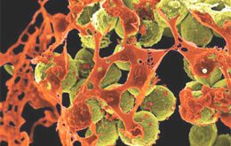 La bacteria, CRE (carbapenem-resistant enterobacteriaceae), fue transmitida a algunos pacientes por instrumentos médicos contaminados durante endoscopías