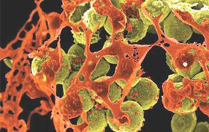 La bacteria, CRE (carbapenem-resistant enterobacteriaceae), fue transmitida a algunos pacientes por instrumentos médicos contaminados durante endoscopías