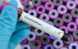 No hay vacunas contra el coronavirus, pero hay medidas preventivas que deben adoptarse.