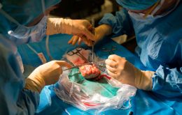 Los xenotrasplantes ofrecen nuevas posibilidades a los pacientes que necesitan órganos